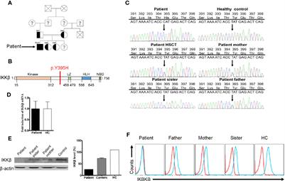 A Novel Homozygous Mutation Destabilizes IKKβ and Leads to Human Combined Immunodeficiency